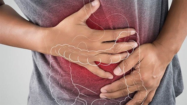 Specialist warns of rising intestinal disorders among young Sri Lankans