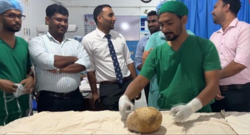 Trincomalee surgeons remove 3.1kg bladder stone, claim world record
