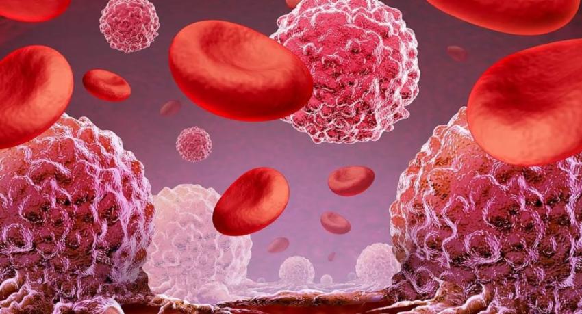 Up to 1,000 children and young people diagnosed with cancer each year in Sri Lanka
