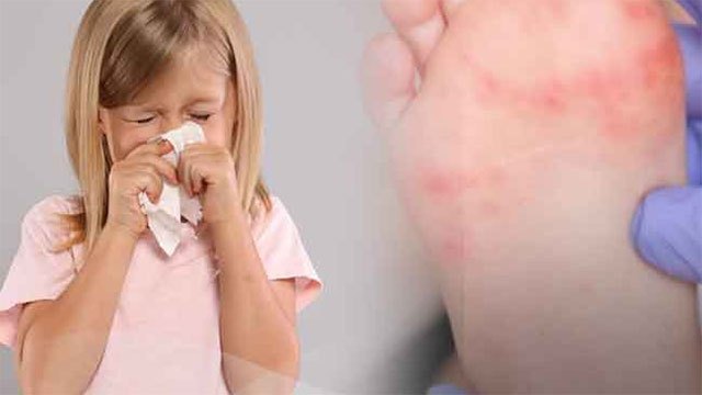 Four illnesses spreading among children, LRH paediatrician urges vigilance