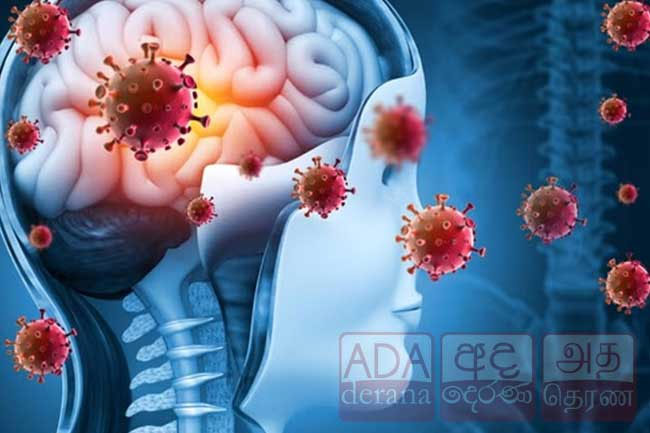Meningitis cases rise to 237 island-wide, mostly schoolchildren, Health Ministry says
