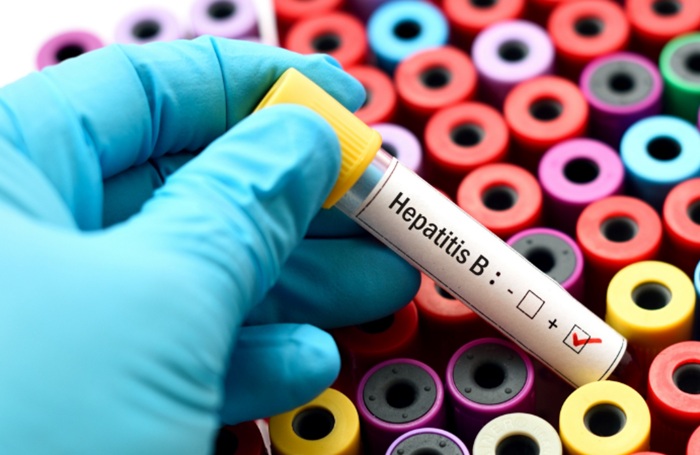 Sri Lanka launches Triple Elimination, adding Hepatitis B screening at all maternity clinics